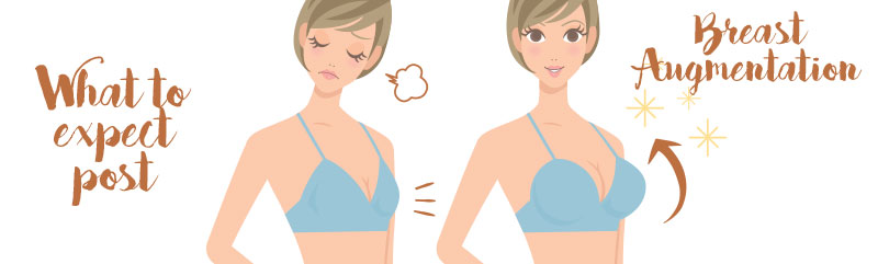 expect breast augmentation re expecting cosmeditour surgery