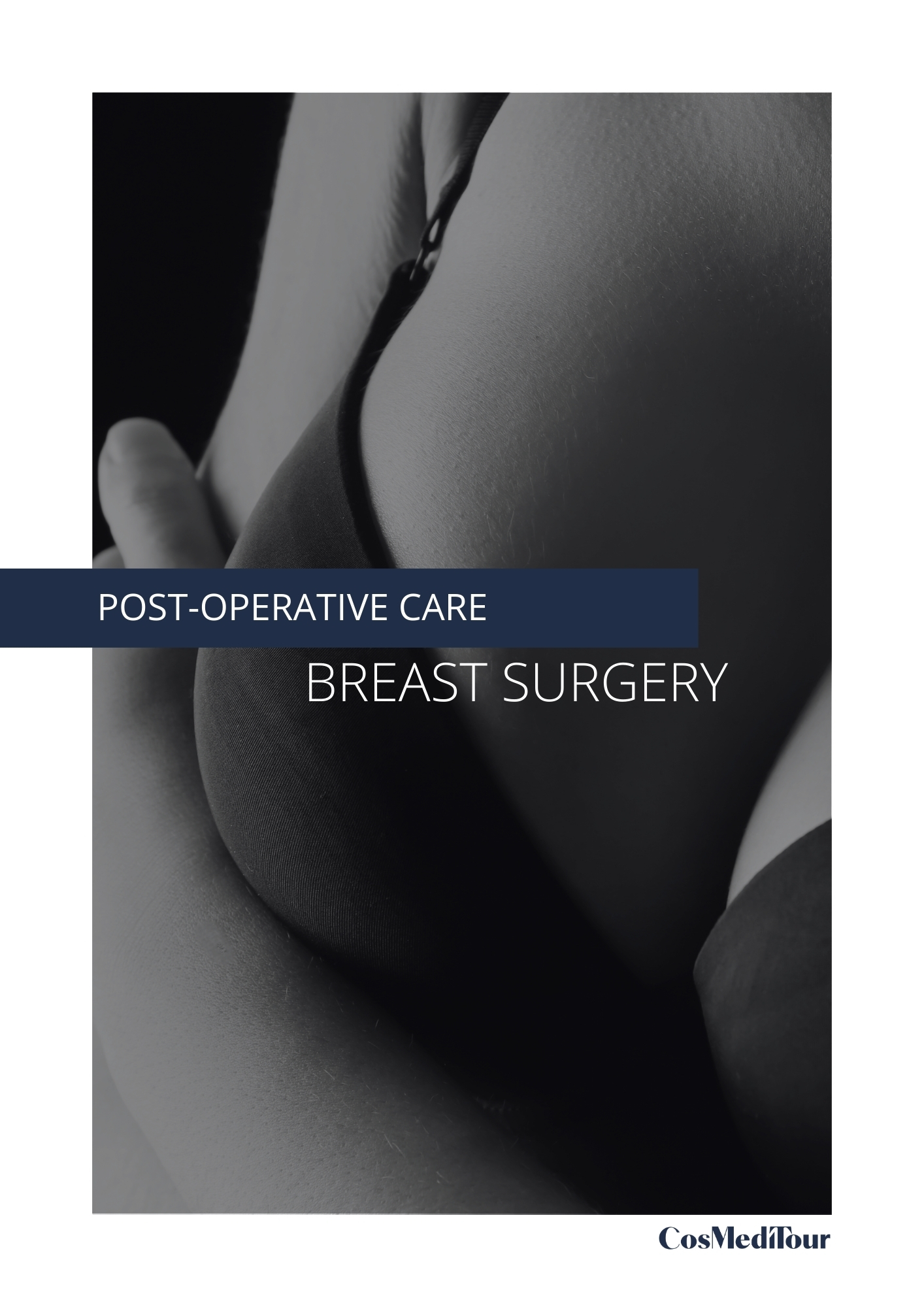 Breast Augmentation Expectation Guide